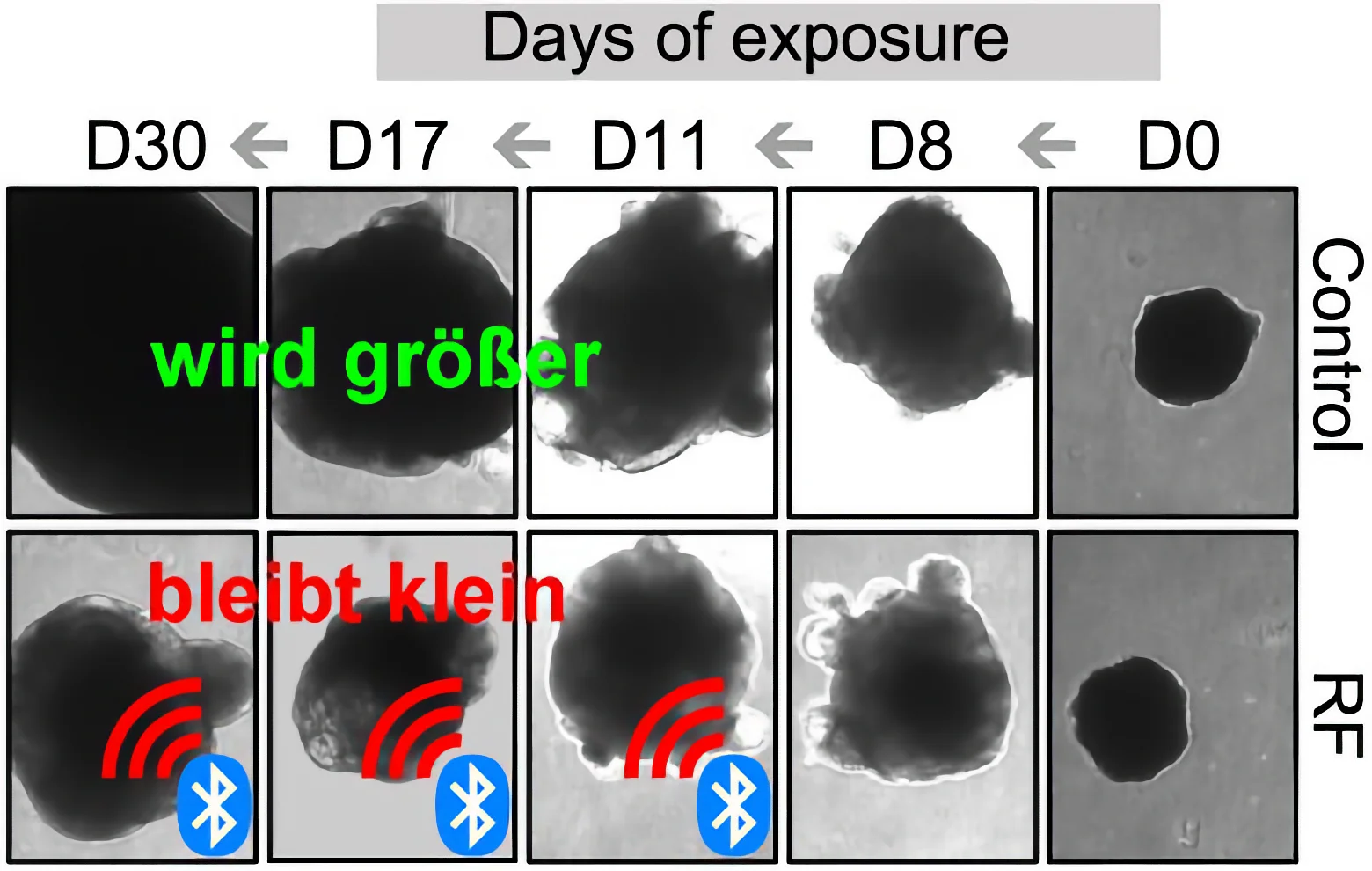 Bluetooth im Kinderzimmer? Studie zeigt massive Schäden am ungeborenen Gehirn