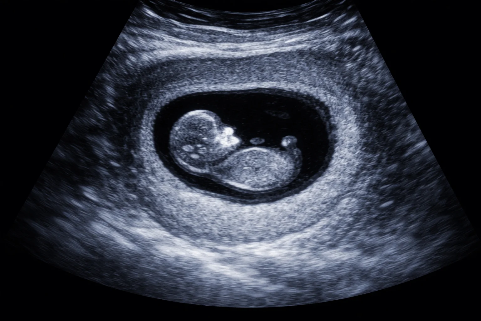 Chemische Abtreibung: Der gefährliche Mythos vom „sicheren Abbruch“