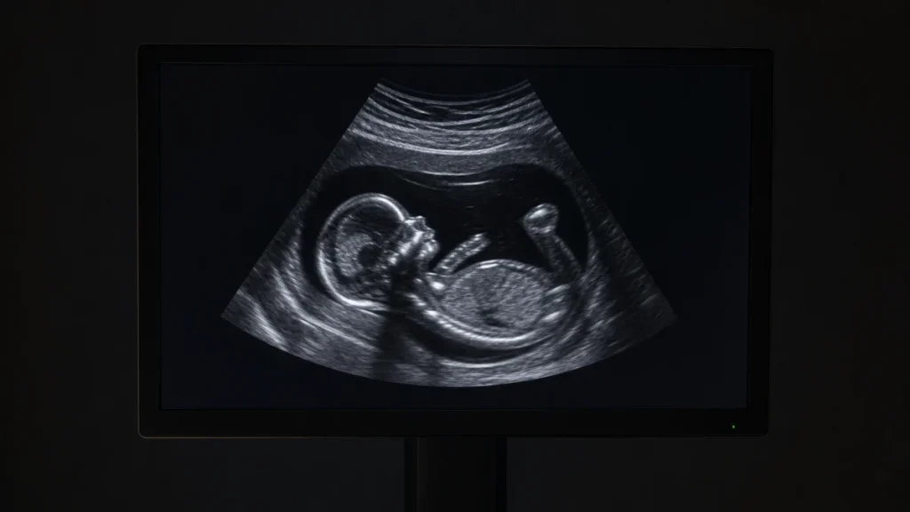 Ein einzelner Ultraschallmonitor zeigt ein ungeborenes Kind im Mutterleib